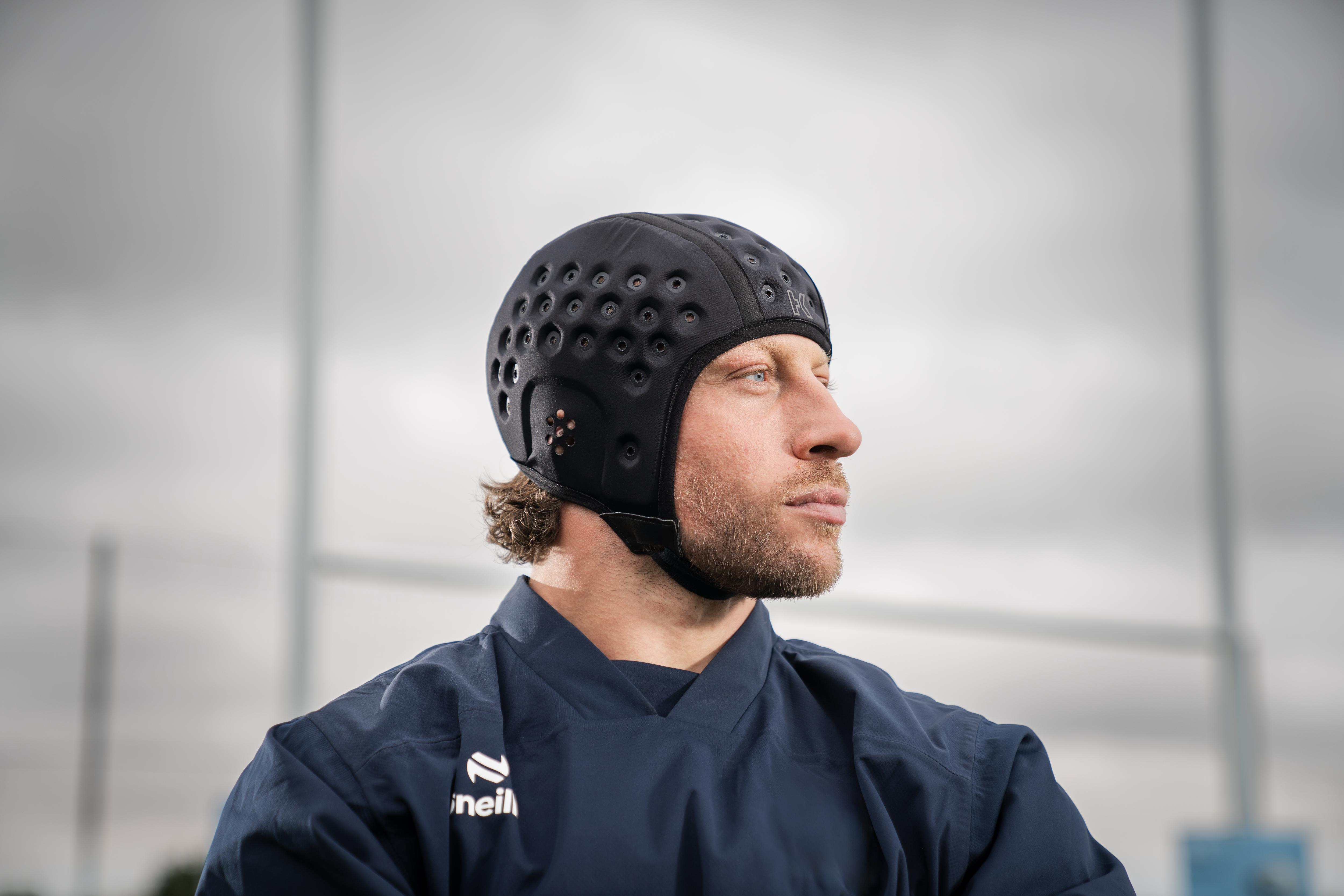 Our Philosophy Behind Player Endorsements - Hedkayse